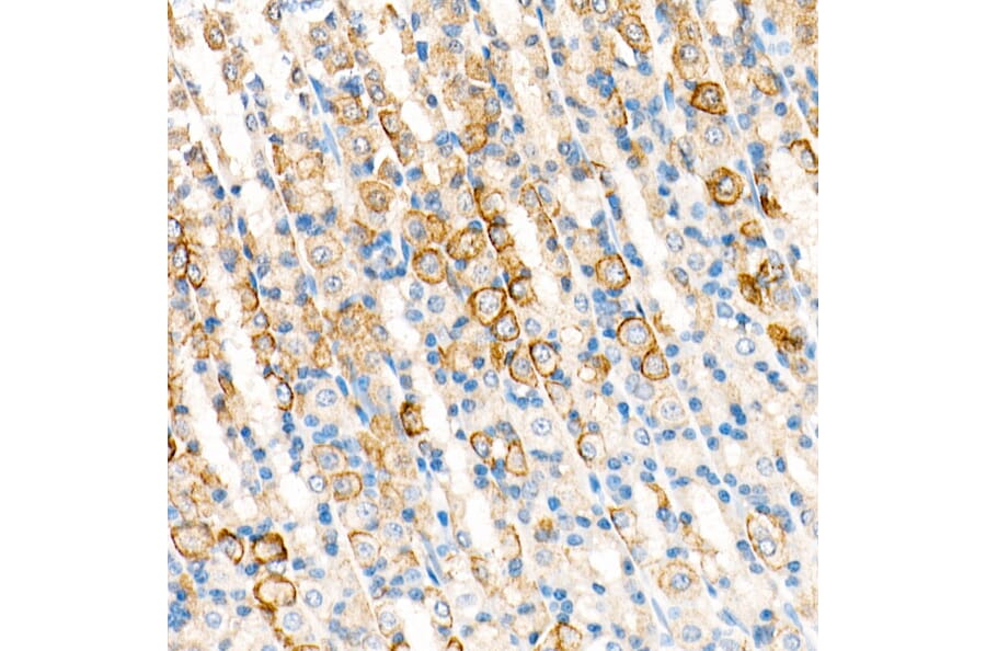 Immunohistochemistry - Anti-Cytokeratin 19 Antibody [ARC0272] (A308569) - Antibodies.com