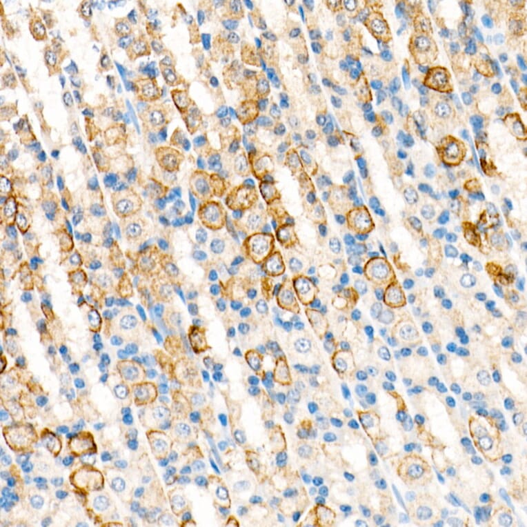 Immunohistochemistry - Anti-Cytokeratin 19 Antibody [ARC0272] (A308569) - Antibodies.com