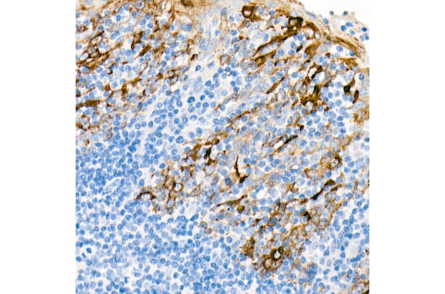 Immunohistochemistry - Anti-Cytokeratin 19 Antibody [ARC0272] (A308569) - Antibodies.com