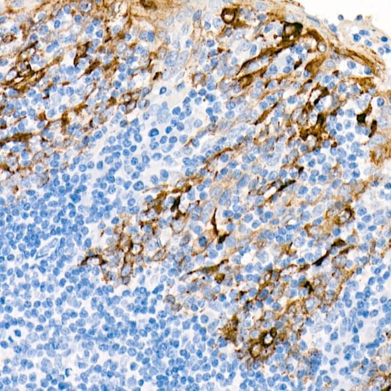 Immunohistochemistry - Anti-Cytokeratin 19 Antibody [ARC0272] (A308569) - Antibodies.com