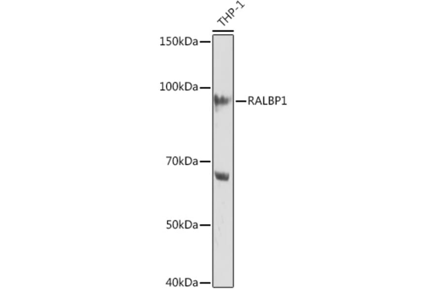 Western Blot - Anti-RALBP1 Antibody [ARC1707] (A308570) - Antibodies.com