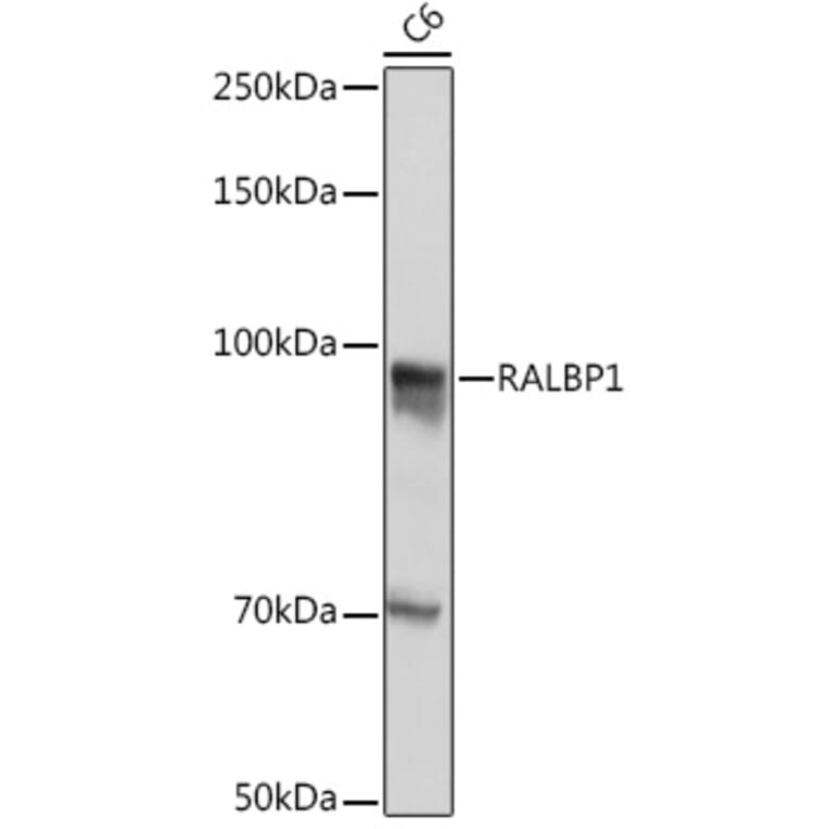 Western Blot - Anti-RALBP1 Antibody [ARC1707] (A308570) - Antibodies.com