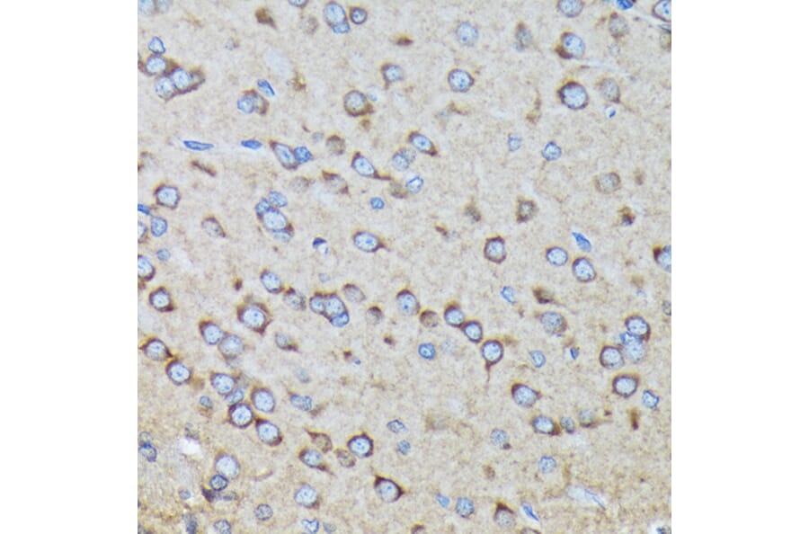 Immunohistochemistry - Anti-RALBP1 Antibody [ARC1707] (A308570) - Antibodies.com