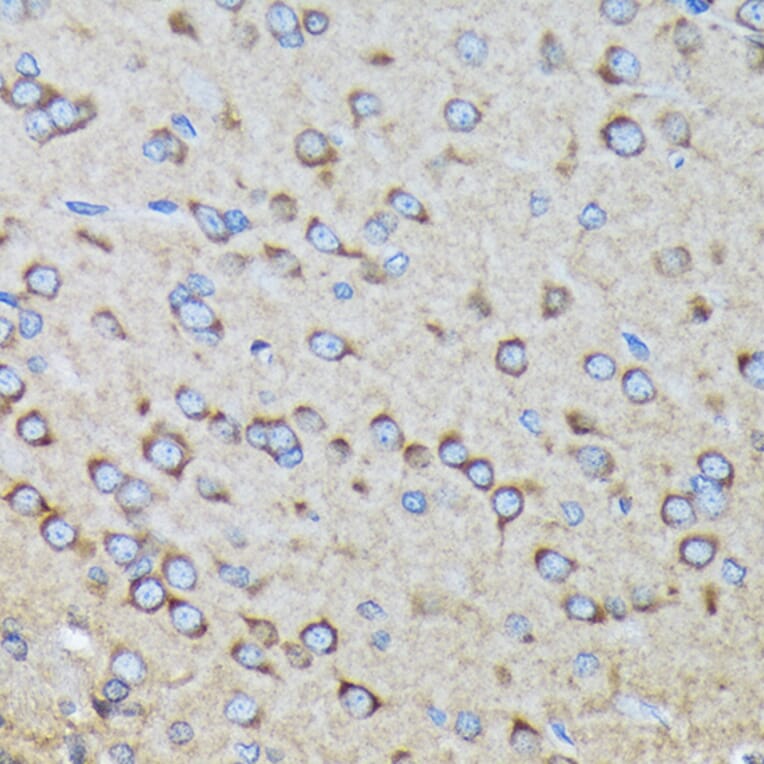 Immunohistochemistry - Anti-RALBP1 Antibody [ARC1707] (A308570) - Antibodies.com