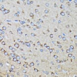 Immunohistochemistry - Anti-RALBP1 Antibody [ARC1707] (A308570) - Antibodies.com