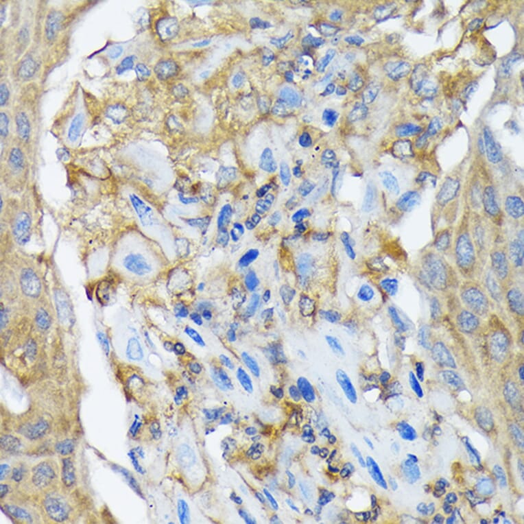 Immunohistochemistry - Anti-RALBP1 Antibody [ARC1707] (A308570) - Antibodies.com
