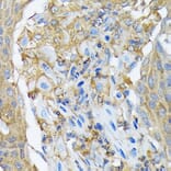 Immunohistochemistry - Anti-RALBP1 Antibody [ARC1707] (A308570) - Antibodies.com