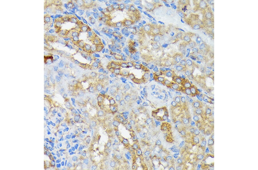 Immunohistochemistry - Anti-RALBP1 Antibody [ARC1707] (A308570) - Antibodies.com