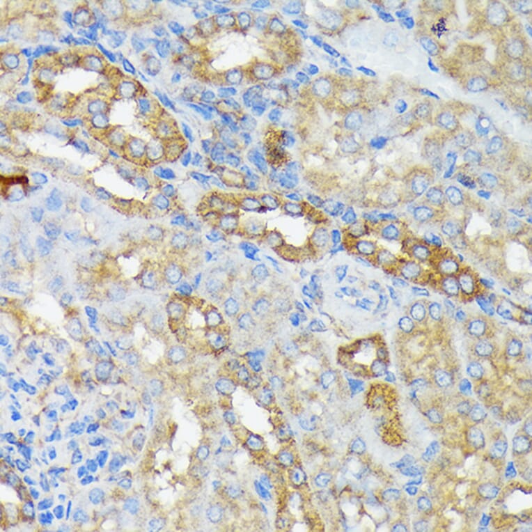 Immunohistochemistry - Anti-RALBP1 Antibody [ARC1707] (A308570) - Antibodies.com