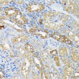 Immunohistochemistry - Anti-RALBP1 Antibody [ARC1707] (A308570) - Antibodies.com