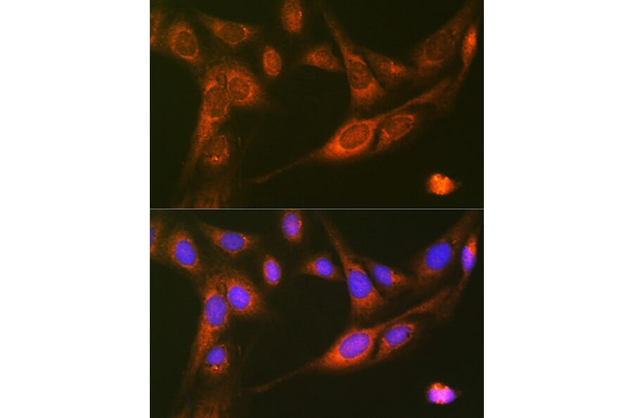 Immunofluorescence - Anti-RALBP1 Antibody [ARC1707] (A308570) - Antibodies.com