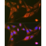 Immunofluorescence - Anti-RALBP1 Antibody [ARC1707] (A308570) - Antibodies.com