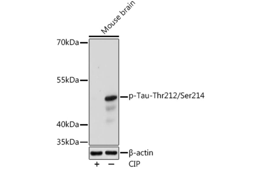 Western Blot - Anti-Tau (phospho Thrhr212 + Ser214) Antibody (A308571) - Antibodies.com