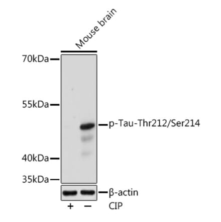 Western Blot - Anti-Tau (phospho Thrhr212 + Ser214) Antibody (A308571) - Antibodies.com