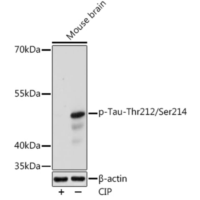 Western Blot - Anti-Tau (phospho Thrhr212 + Ser214) Antibody (A308571) - Antibodies.com