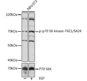 Western Blot - Anti-S6K1 (phospho Thr421 + Ser424) Antibody (A308572) - Antibodies.com