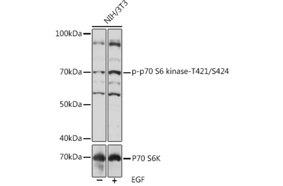 Western Blot - Anti-S6K1 (phospho Thr421 + Ser424) Antibody (A308572) - Antibodies.com