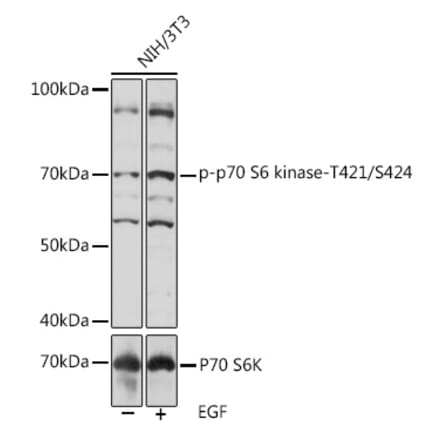 Western Blot - Anti-S6K1 (phospho Thr421 + Ser424) Antibody (A308572) - Antibodies.com
