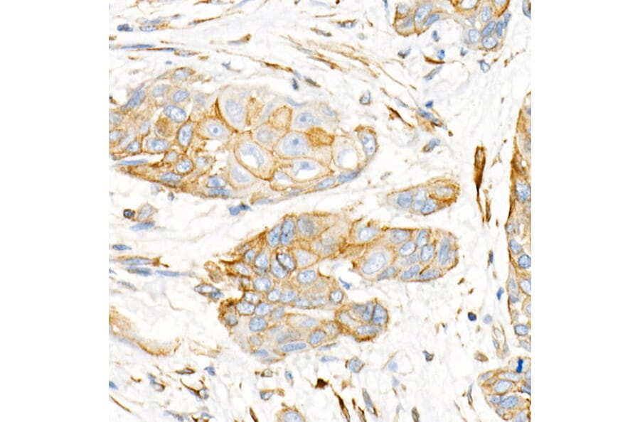 Immunohistochemistry - Anti-Plectin Antibody [ARC2270] (A308573) - Antibodies.com