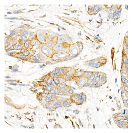 Immunohistochemistry - Anti-Plectin Antibody [ARC2270] (A308573) - Antibodies.com