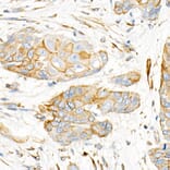 Immunohistochemistry - Anti-Plectin Antibody [ARC2270] (A308573) - Antibodies.com