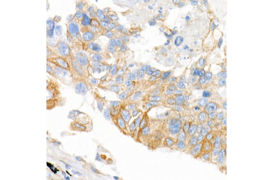 Immunohistochemistry - Anti-Plectin Antibody [ARC2270] (A308573) - Antibodies.com