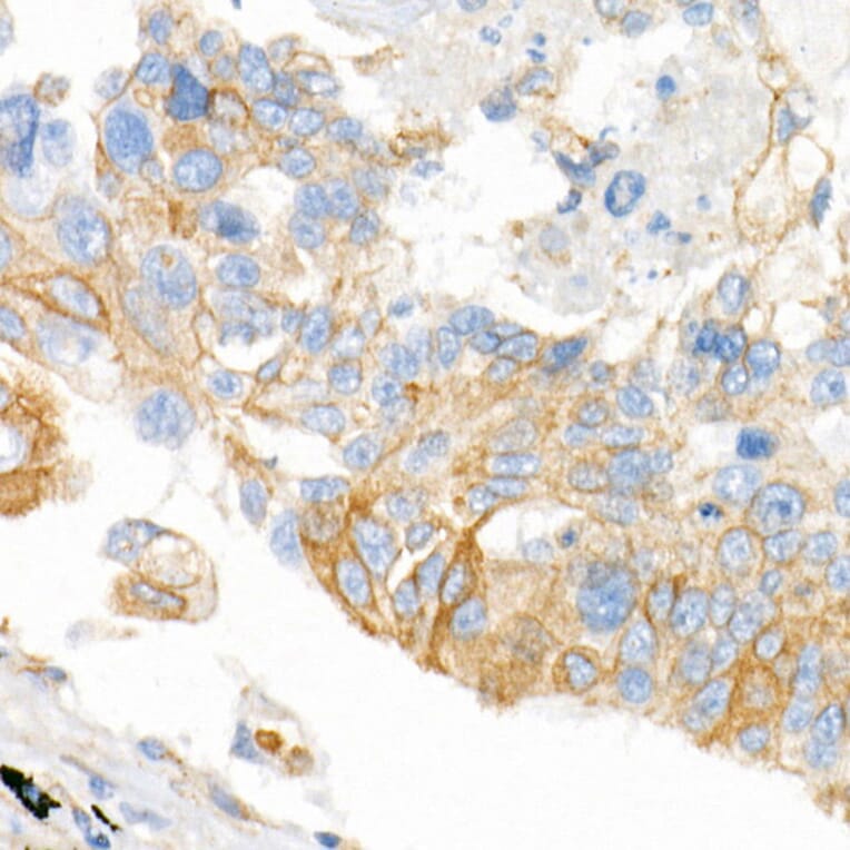 Immunohistochemistry - Anti-Plectin Antibody [ARC2270] (A308573) - Antibodies.com