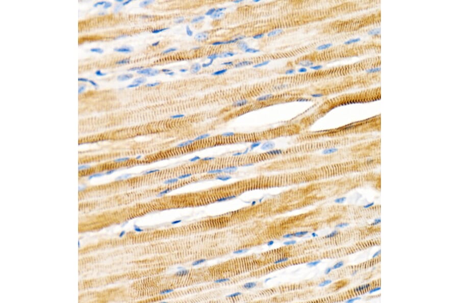 Immunohistochemistry - Anti-Plectin Antibody [ARC2270] (A308573) - Antibodies.com