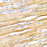 Immunohistochemistry - Anti-Plectin Antibody [ARC2270] (A308573) - Antibodies.com