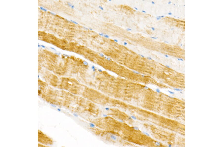 Immunohistochemistry - Anti-Plectin Antibody [ARC2270] (A308573) - Antibodies.com