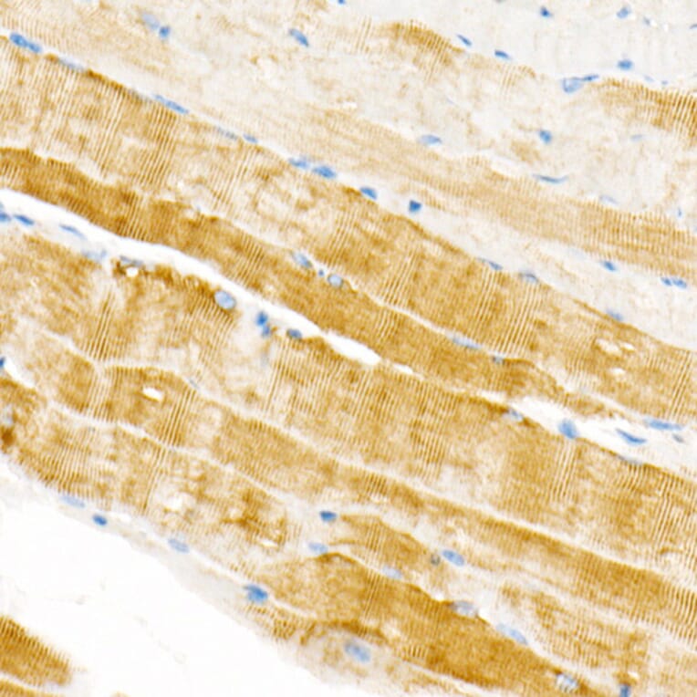 Immunohistochemistry - Anti-Plectin Antibody [ARC2270] (A308573) - Antibodies.com