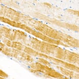 Immunohistochemistry - Anti-Plectin Antibody [ARC2270] (A308573) - Antibodies.com
