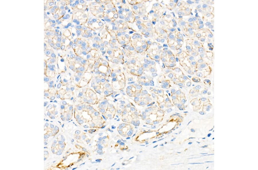 Immunohistochemistry - Anti-Plectin Antibody [ARC2270] (A308573) - Antibodies.com