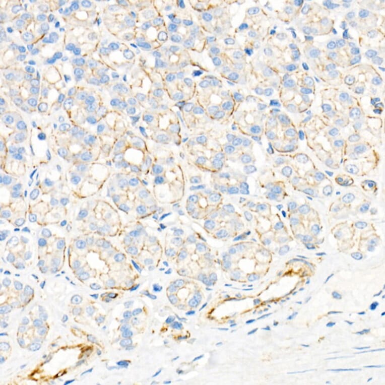 Immunohistochemistry - Anti-Plectin Antibody [ARC2270] (A308573) - Antibodies.com