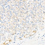 Immunohistochemistry - Anti-Plectin Antibody [ARC2270] (A308573) - Antibodies.com