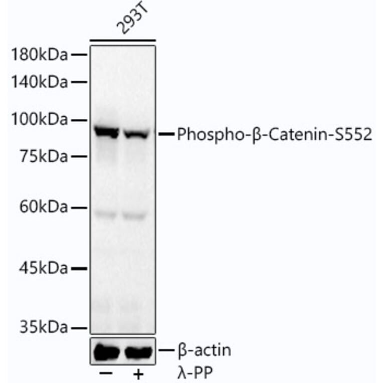Western Blot - Anti-beta Catenin (phospho Ser552) Antibody [ARC54001] (A308575) - Antibodies.com