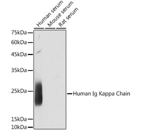 Western Blot - Anti-Kappa light chain Antibody [ARC2247] (A308577) - Antibodies.com