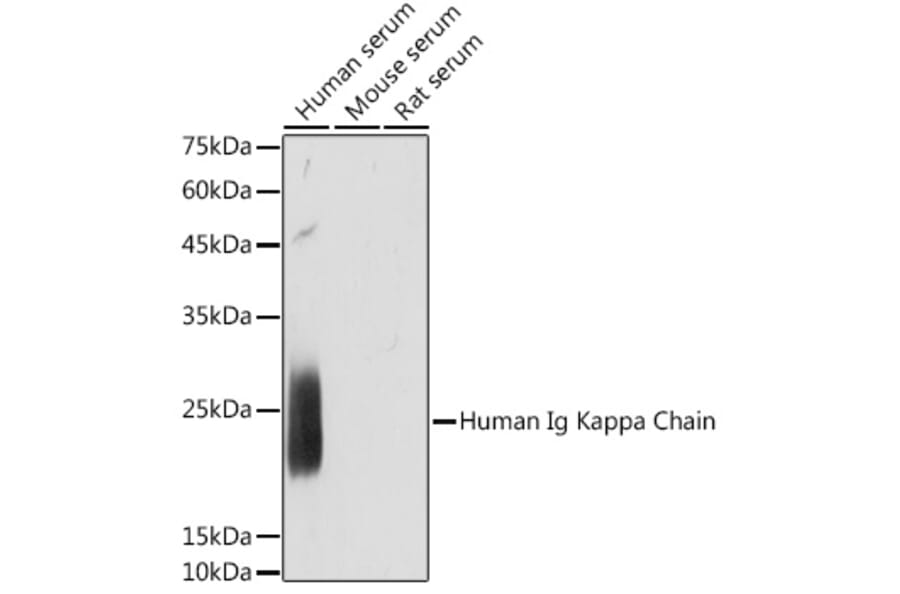 Western Blot - Anti-Kappa light chain Antibody [ARC2247] (A308577) - Antibodies.com