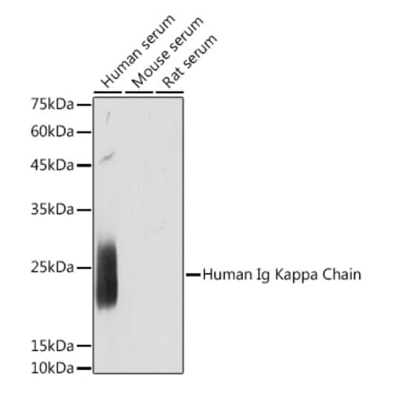 Western Blot - Anti-Kappa light chain Antibody [ARC2247] (A308577) - Antibodies.com