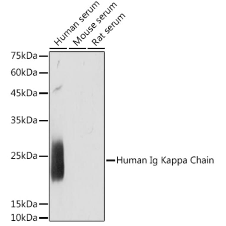 Western Blot - Anti-Kappa light chain Antibody [ARC2247] (A308577) - Antibodies.com