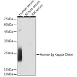 Western Blot - Anti-Kappa light chain Antibody [ARC2247] (A308577) - Antibodies.com