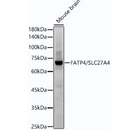 Western Blot - Anti-SLC27A4 / FATP4 Antibody [ARC53579] (A308579) - Antibodies.com