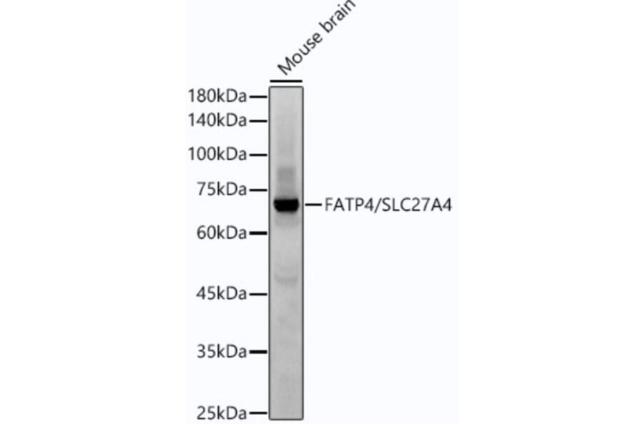 Western Blot - Anti-SLC27A4/FATP4 Antibody [ARC53579] (A308579) - Antibodies.com