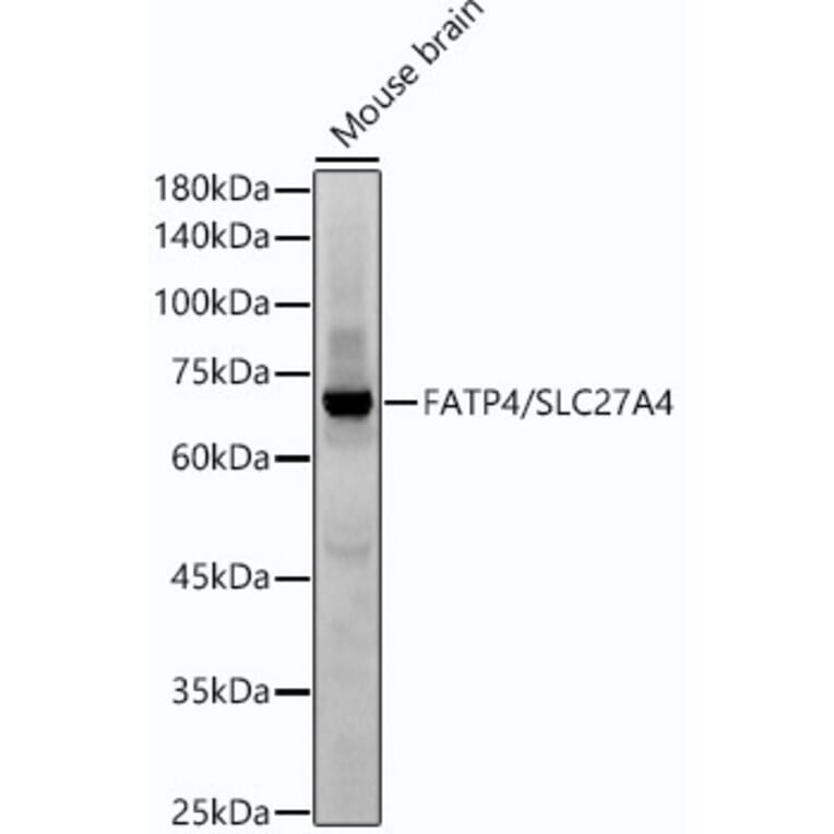 Western Blot - Anti-SLC27A4/FATP4 Antibody [ARC53579] (A308579) - Antibodies.com
