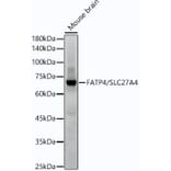 Western Blot - Anti-SLC27A4/FATP4 Antibody [ARC53579] (A308579) - Antibodies.com