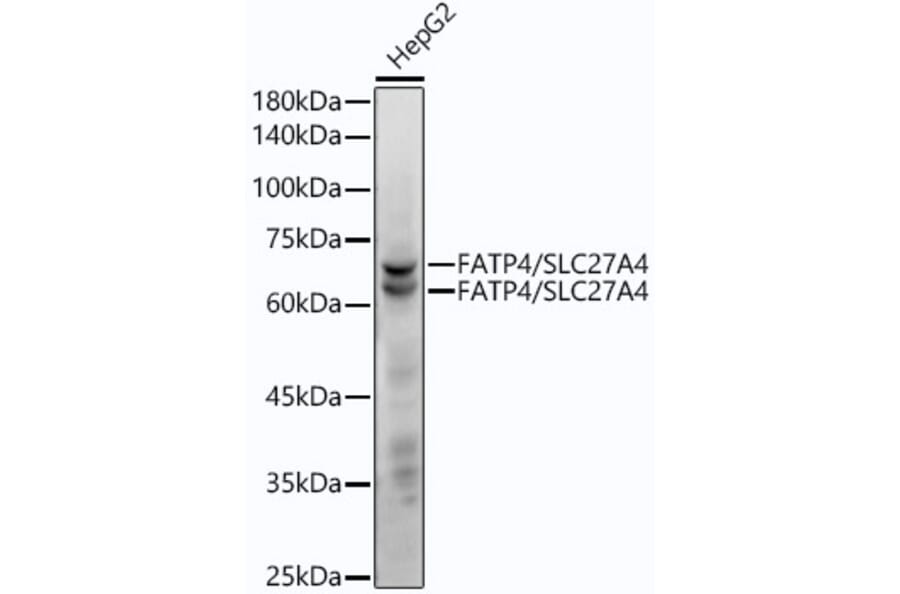Western Blot - Anti-SLC27A4/FATP4 Antibody [ARC53579] (A308579) - Antibodies.com