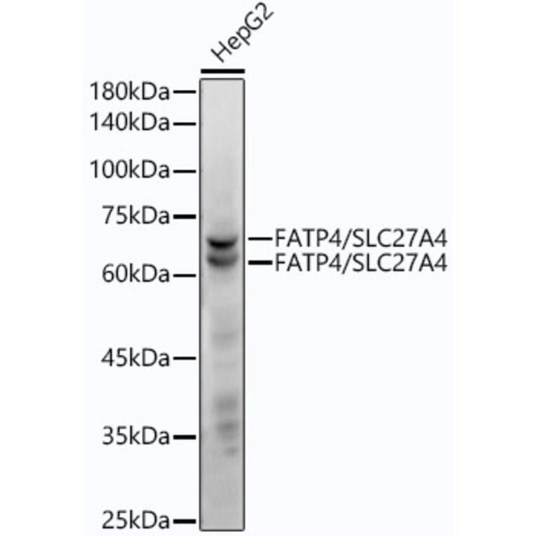 Western Blot - Anti-SLC27A4/FATP4 Antibody [ARC53579] (A308579) - Antibodies.com