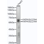 Western Blot - Anti-SLC27A4/FATP4 Antibody [ARC53579] (A308579) - Antibodies.com