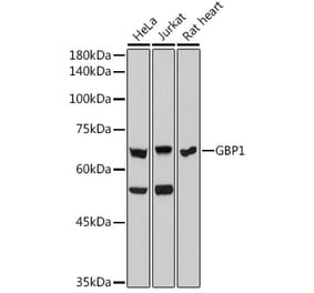 Western Blot - Anti-GBP1 Antibody [ARC2521] (A308580) - Antibodies.com