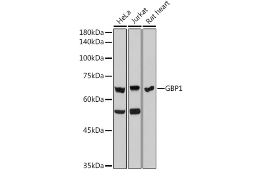 Western Blot - Anti-GBP1 Antibody [ARC2521] (A308580) - Antibodies.com